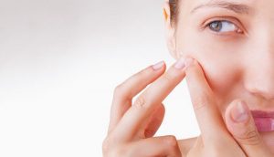 sau khi nặn mụn ở spa nên làm gì