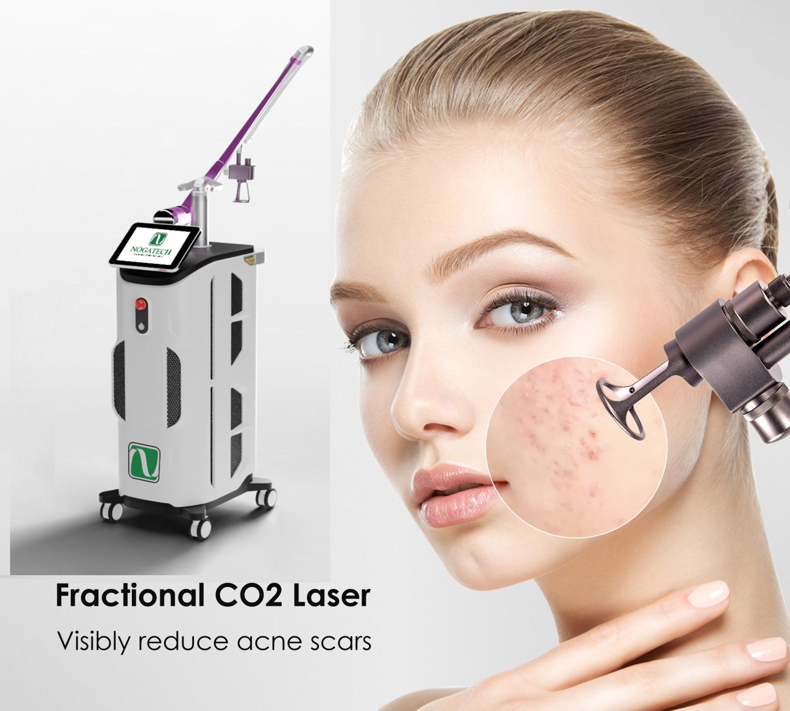 Laser CO2 Fractional: Khi nào Clinic nên đầu tư và lựa chọn thiết bị như thế nào? 1 Laser CO2 Fractional