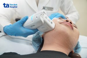 Nâng Cơ Hifu Liftera tại Bệnh Viện Tâm Anh